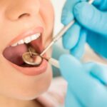Tratamento de Endodontia (Canal)