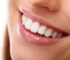 Tratamento de Implantes Dentários